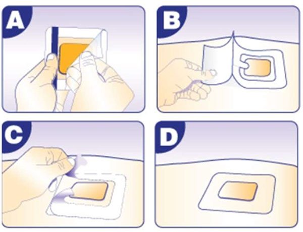 Pharmacoll Comfort Hidrokollid kötszer